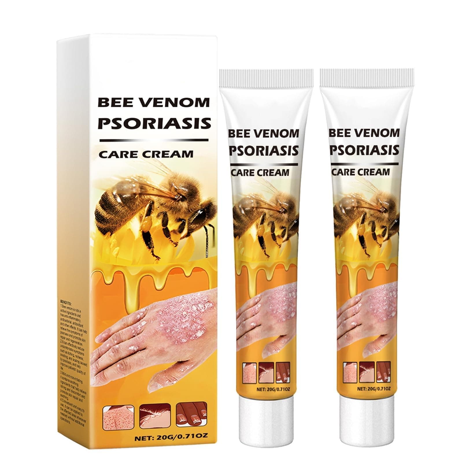 Bee Venom Psoriasis Cream, Bee Venom Cream for Psoriasis, Soothing Pso-riasis Cre-am, Body Cre-am for Redness & Itching, Hand & Leg & Arm Body Care(2PCS)